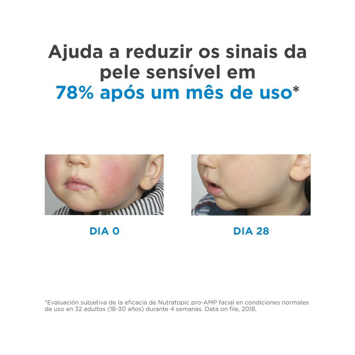 Creme Facial ISDIN Nutratopic Pro-AMP Pele Atópica 50ml — imagem 3 | Farmácia Resyla