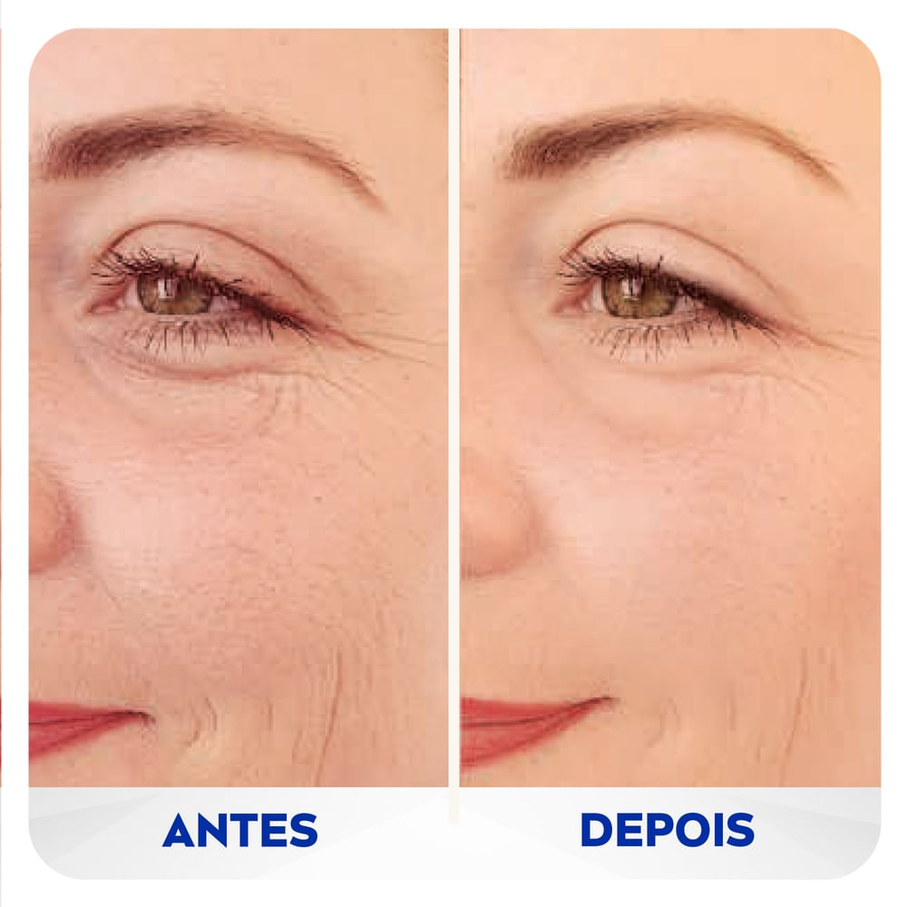 Creme Facial Nivea Q10 Expert Antissinais Preenchedor 15ml — imagem 3 | Farmácia Resyla