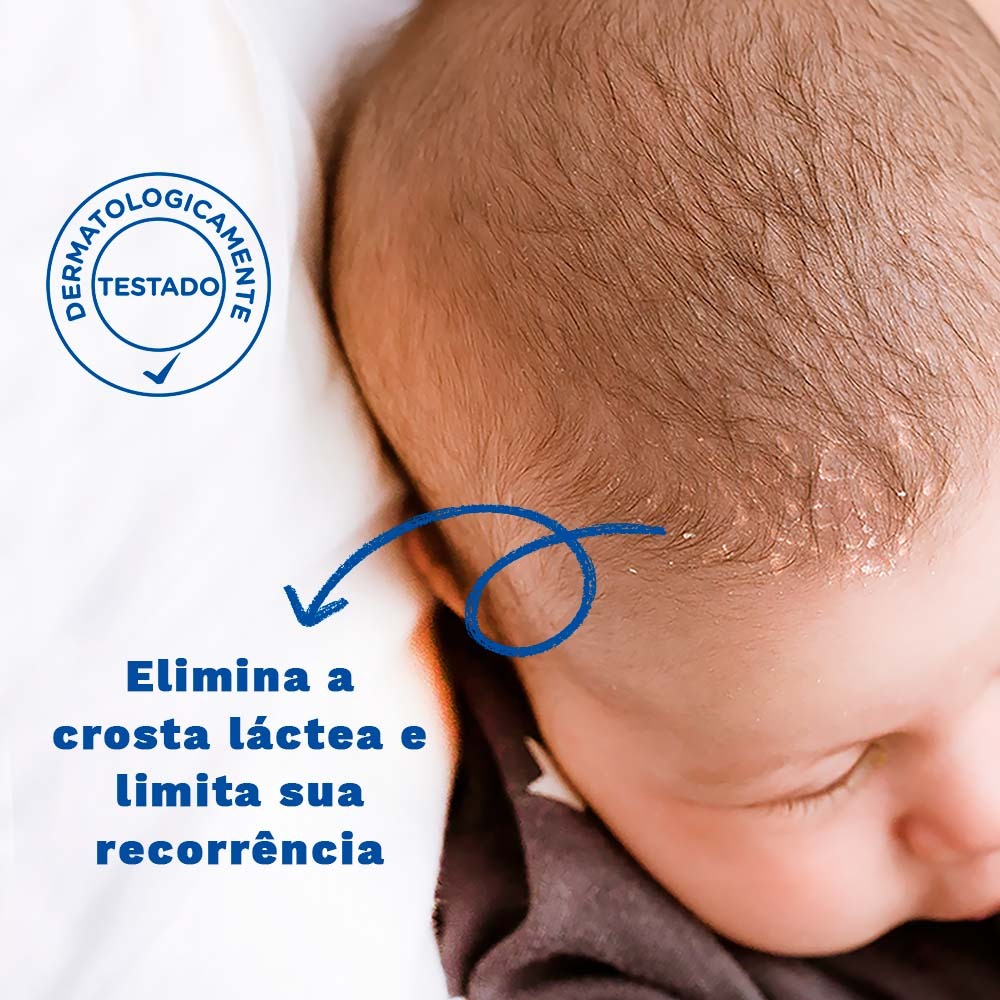 Creme para Crosta Láctea Mustela Stelaker Bebê Hipoalergênico 40ml — imagem 3 | Farmácia Resyla