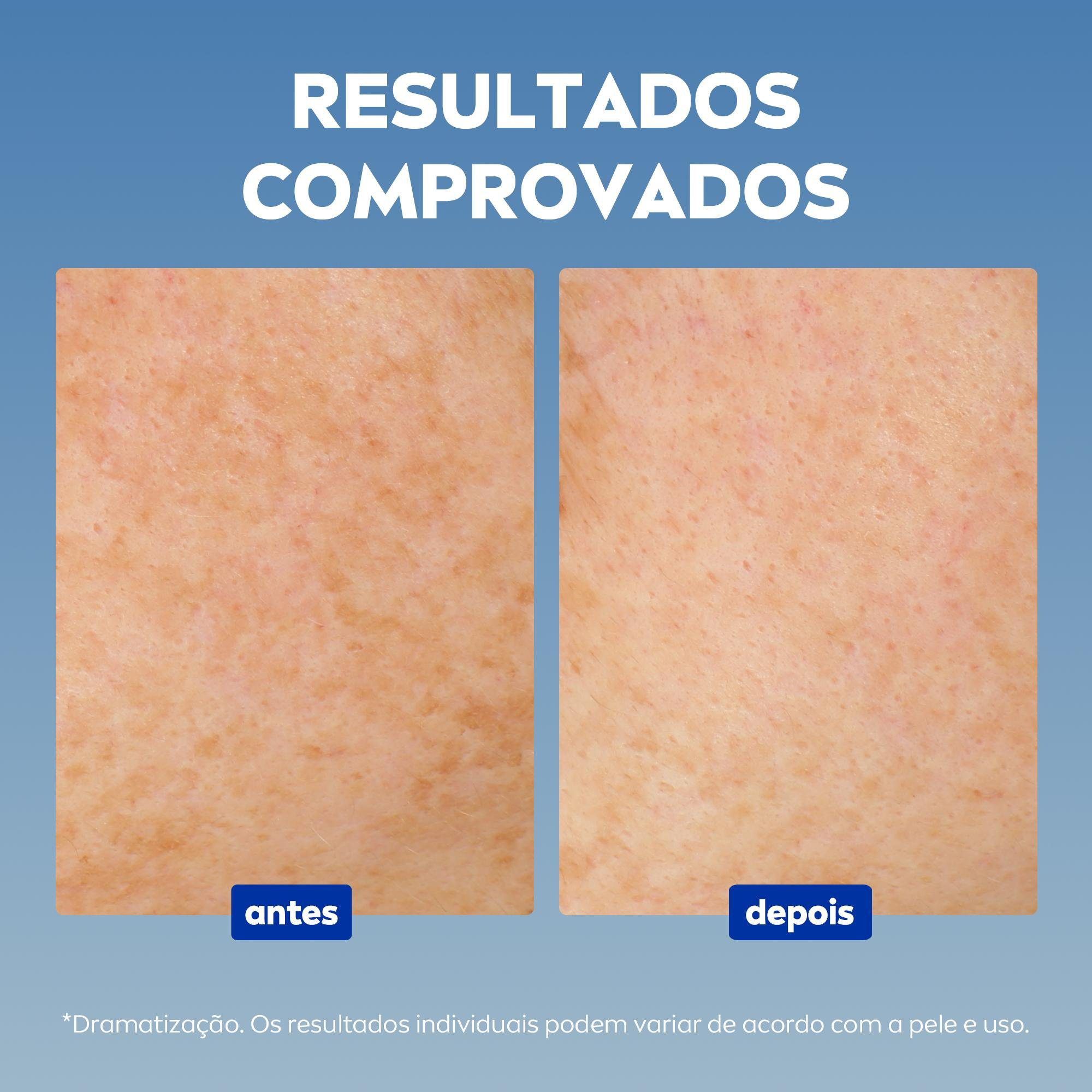 Fluido Facial Nivea Cellular Luminous 630 Antimanchas FPS 50 40ml — imagem 4 | Farmácia Resyla