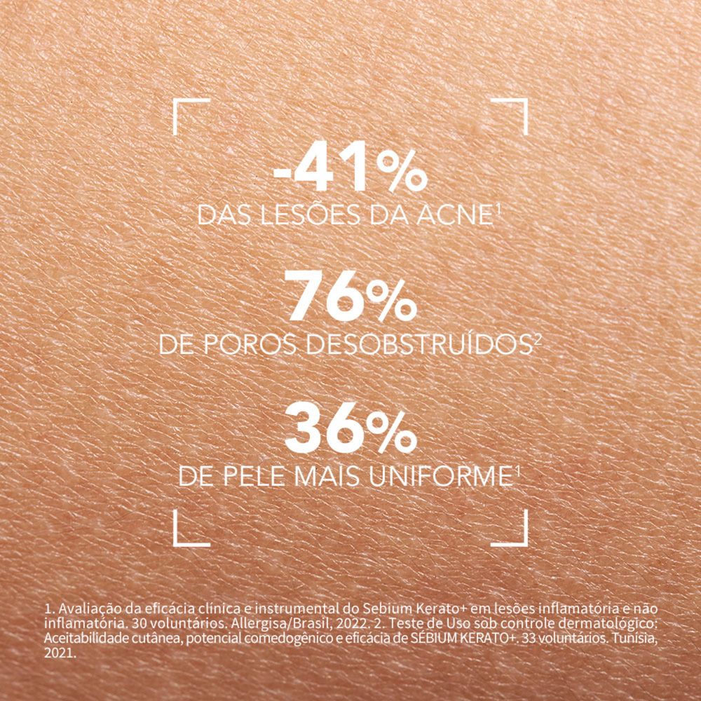 Gel Creme Facial Bioderma Sébium Kerato+ Antiacne e Antimarcas 30ml — imagem 4 | Farmácia Resyla
