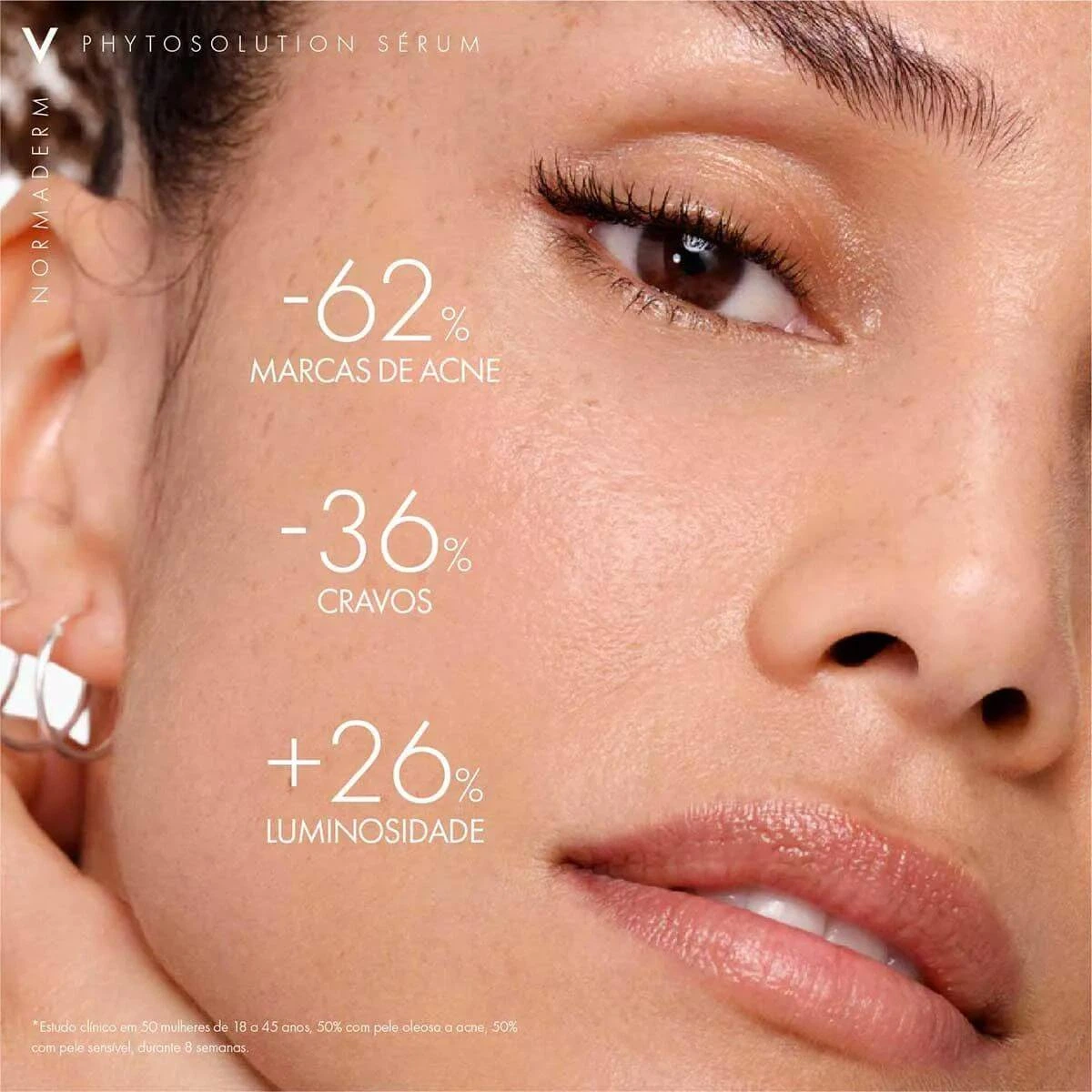 CREME VICHY NORMADERM PHYTOSOLUTION 50ML — imagem 5 | Farmácia Resyla