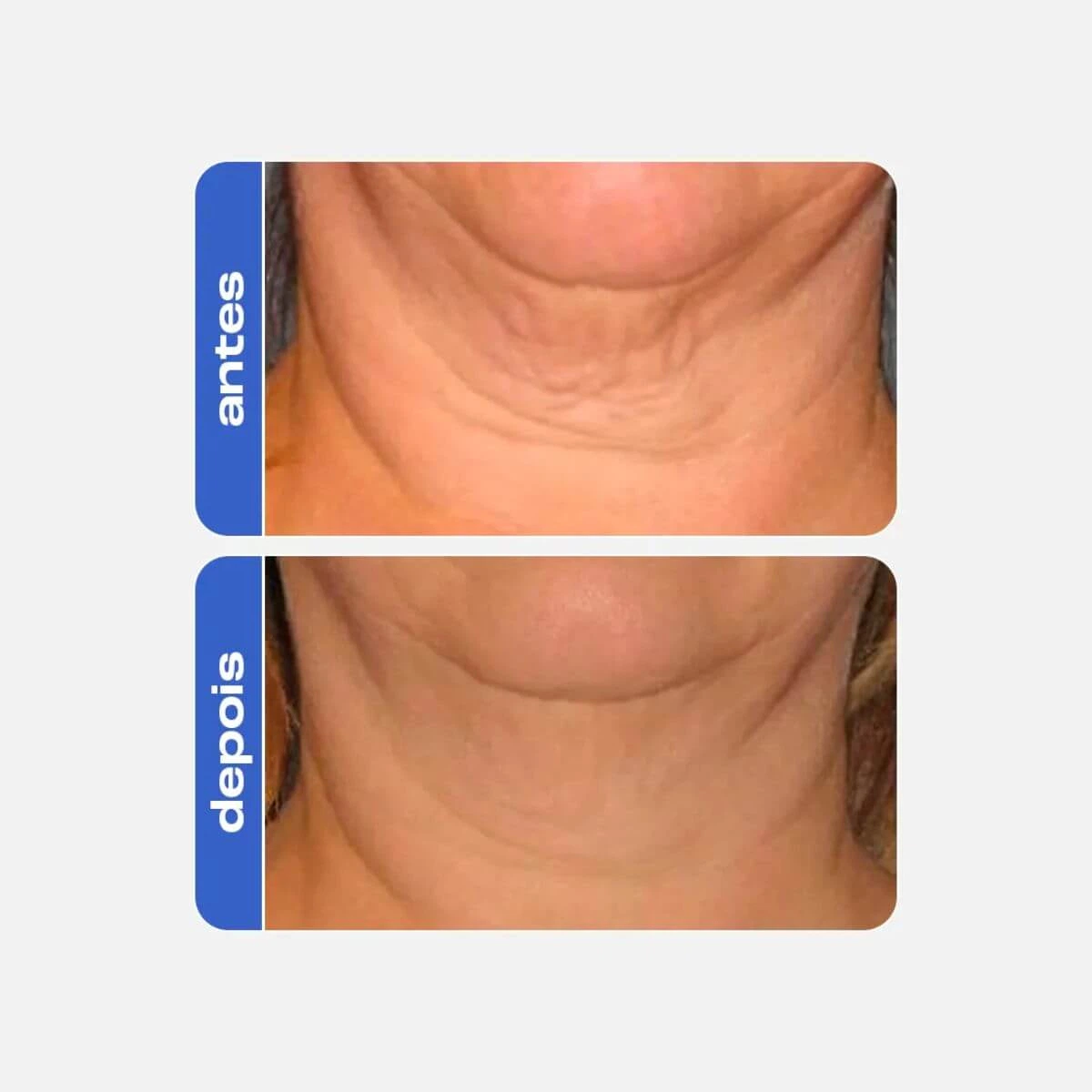 CREME FIRMADOR ANTI-IDADE PEPTIDE CREAM CREAMY 30G — imagem 5 | Farmácia Resyla