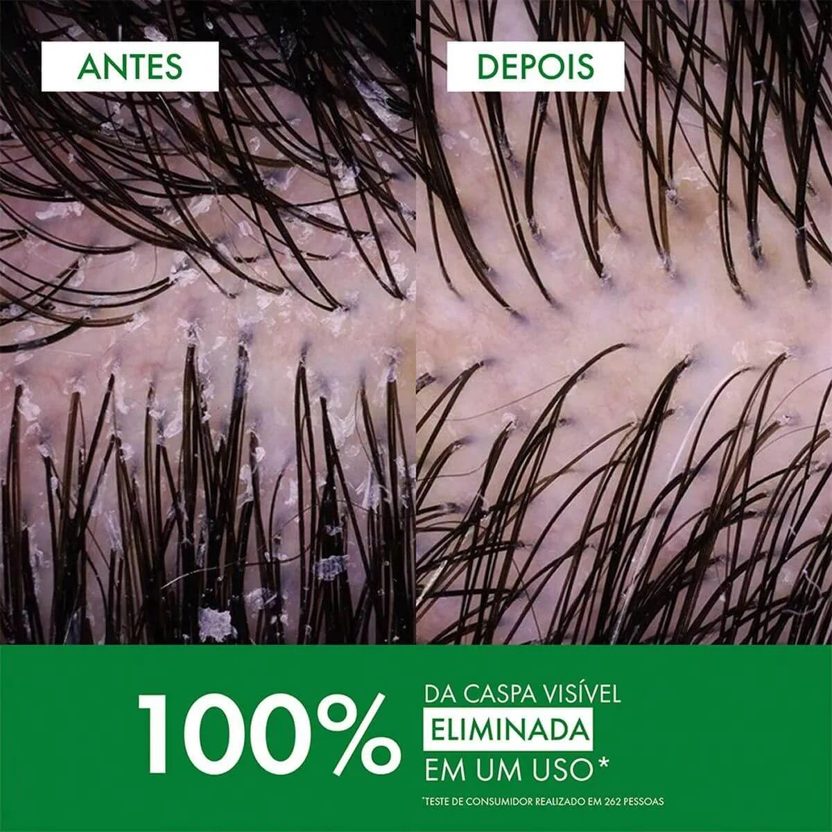 SHAMPOO VICHY DERCOS REFIL ANTICASPA DS NORMAL 200G — imagem 4 | Farmácia Resyla