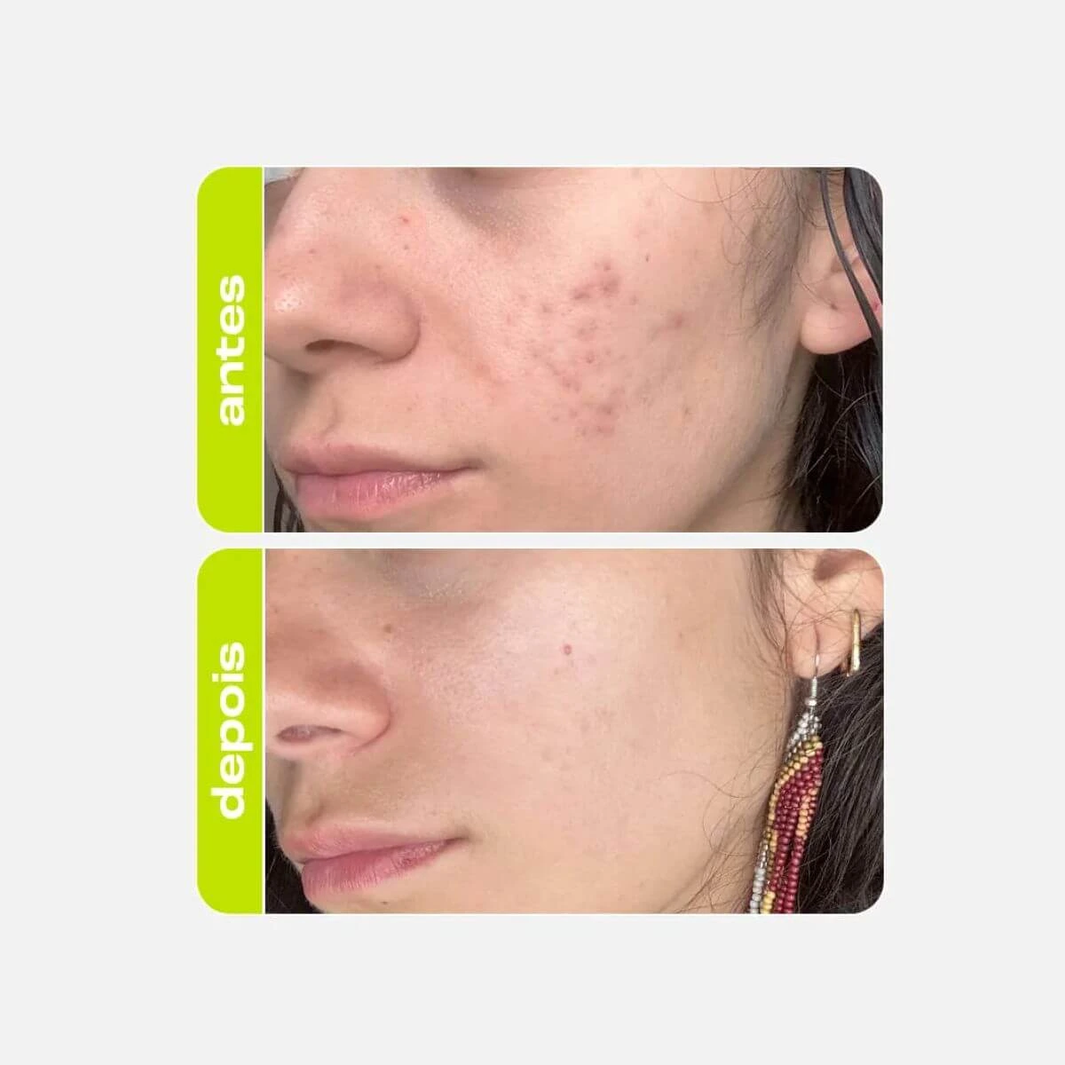 TÔNICO CLAREADOR ÁCIDO TRANEXÂMICO CREAMY 90ML — imagem 3 | Farmácia Resyla