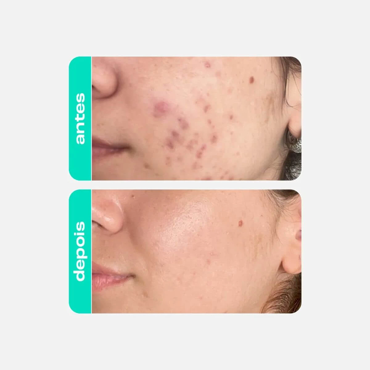 GEL-CREME RETEXTURIZADOR GLICOINTENSE PEEL CREAMY 30G — imagem 3 | Farmácia Resyla