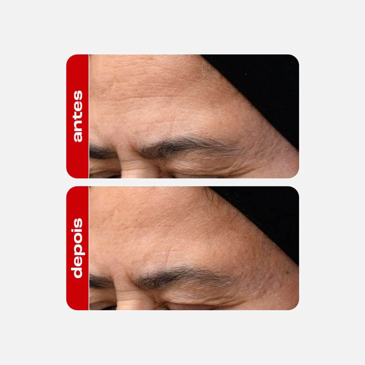 SÉRUM FACIAL ANTI-IDADE RETINAL 30G — imagem 4 | Farmácia Resyla