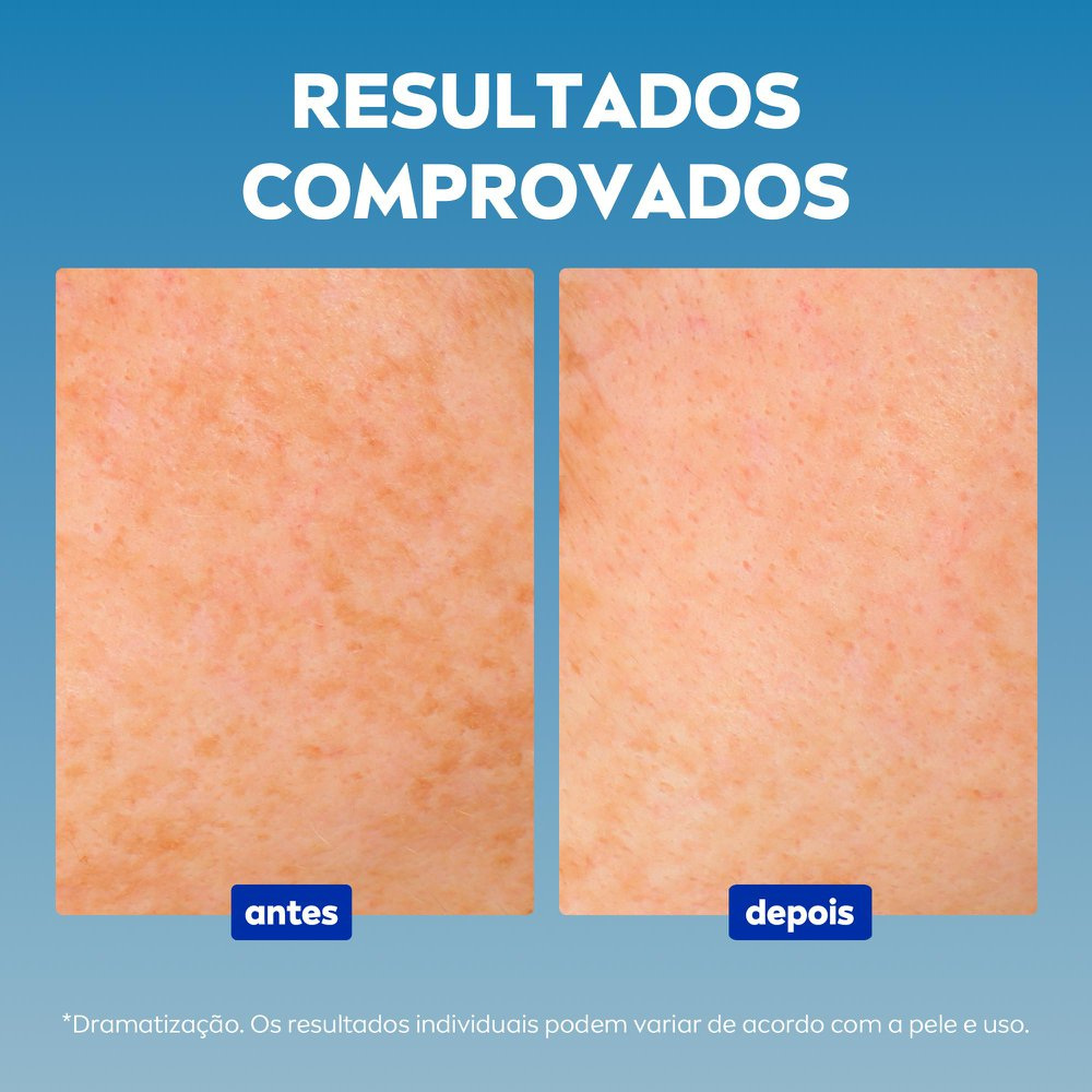 Sérum Facial Nivea Cellular Luminous 630 Antispot 30ml — imagem 4 | Farmácia Resyla
